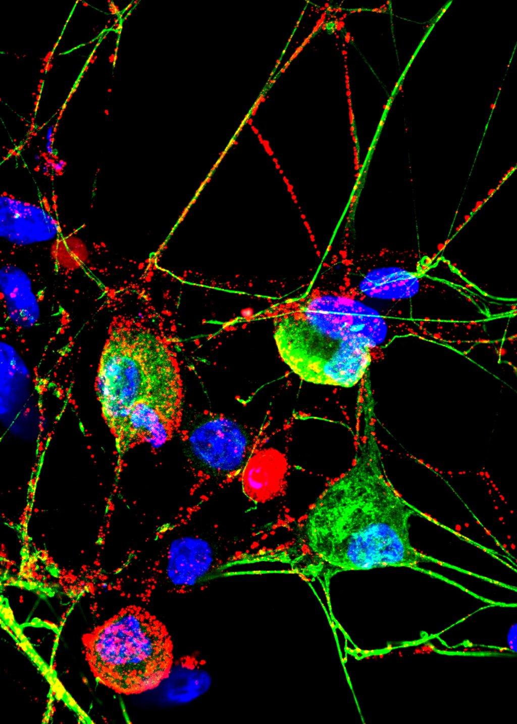 Original fluorescence microscopy image of sensory neurons, showing neuronal membrane proteasome labeling in red and sensory neurons in green